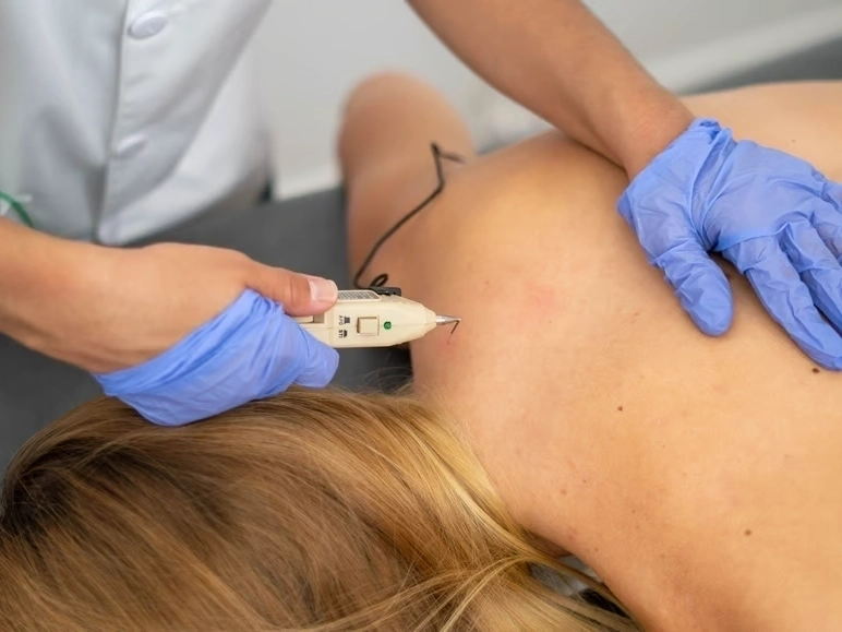 Auto Accident Injury Treatment in McDonough, GA