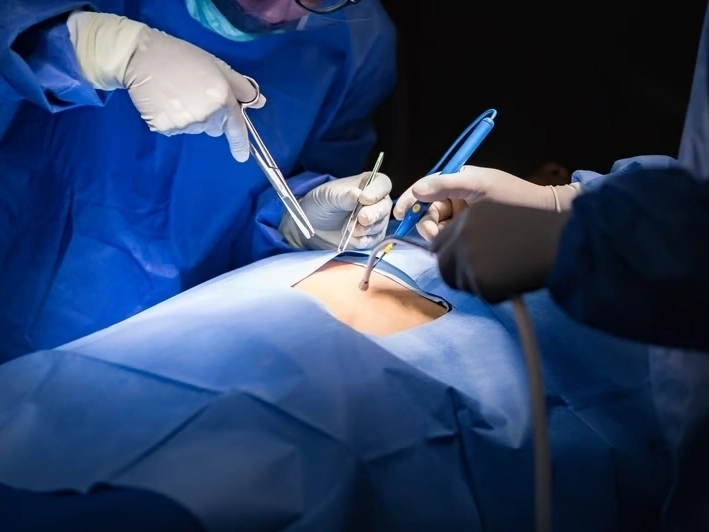 Professional service work by Premier Injury Specialists in McDonough