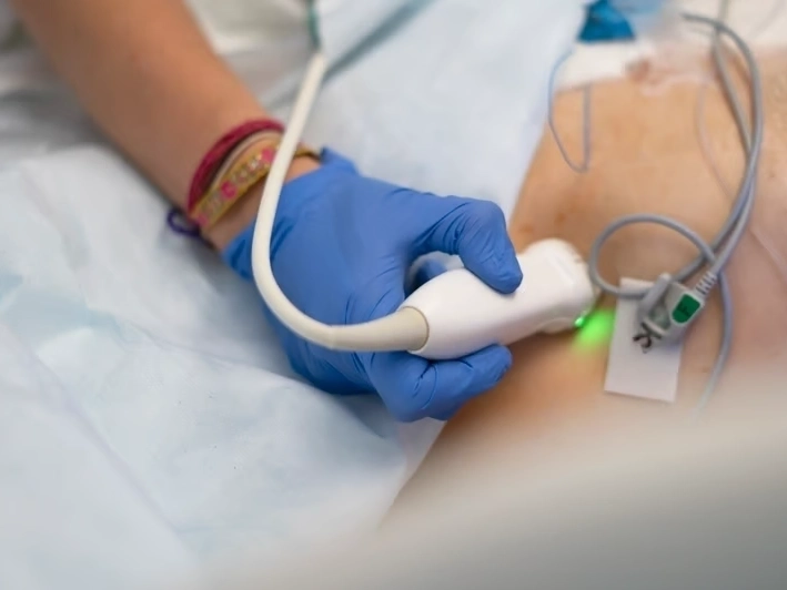 Professional Radiofrequency Ablation Therapy services by Premier Injury Specialists in McDonough, GA — licensed Injury Specialists provider