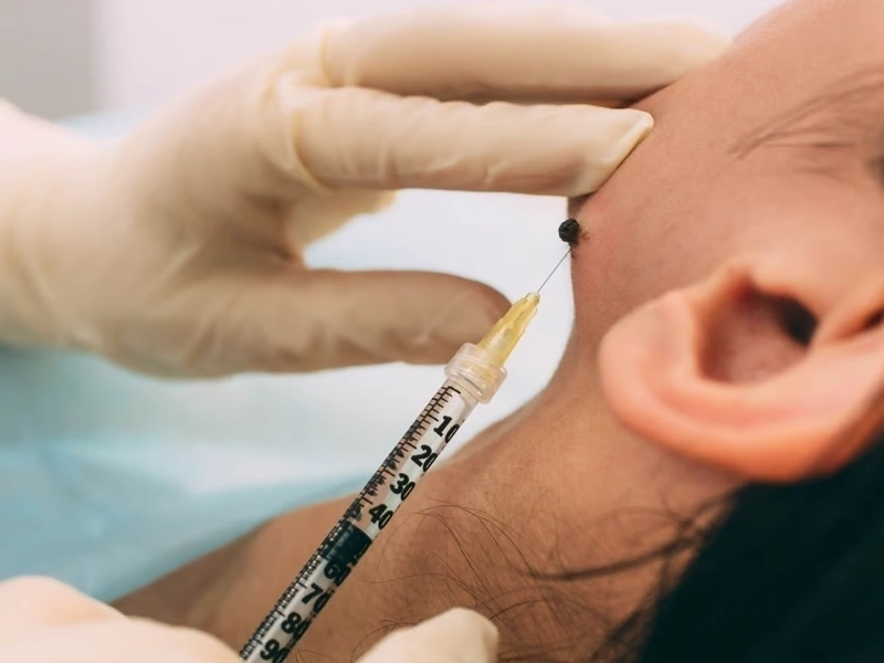 Professional Occipital Nerve Block Treatment services by Premier Injury Specialists in McDonough, GA — licensed Injury Specialists provider